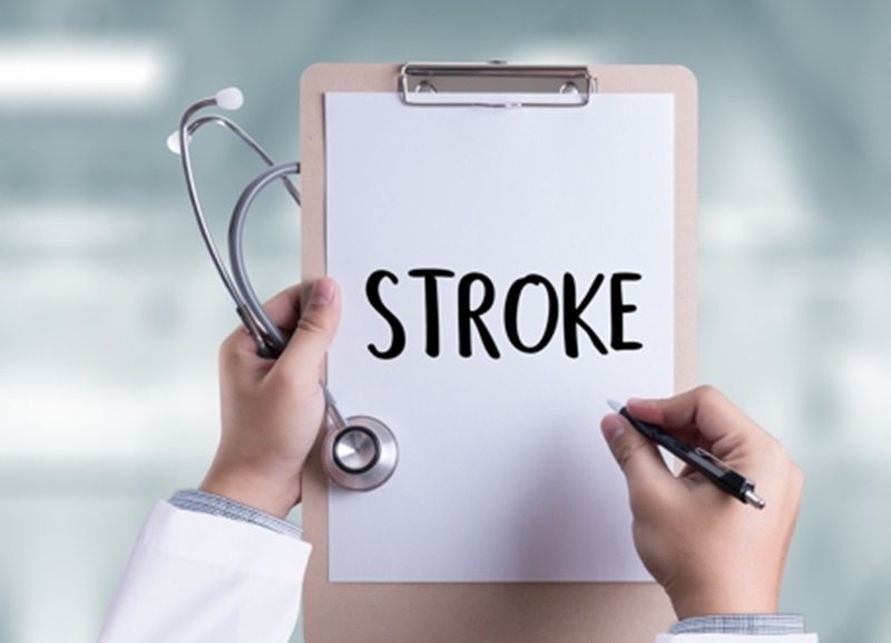 Stroke