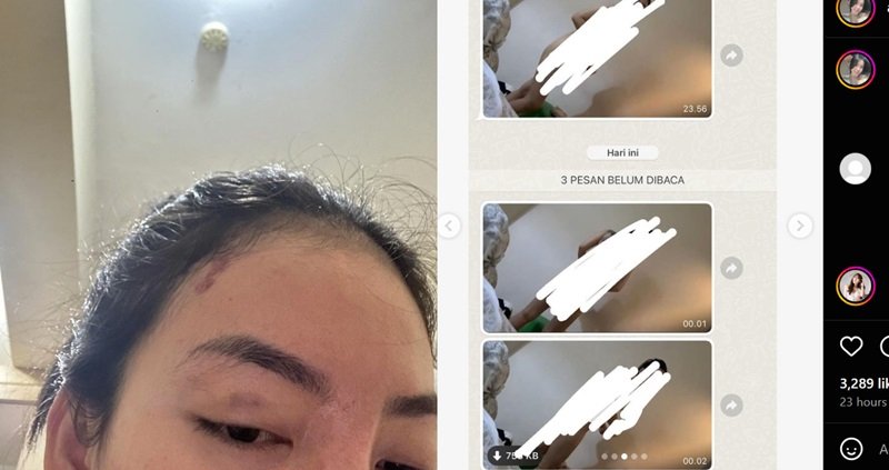 Viral