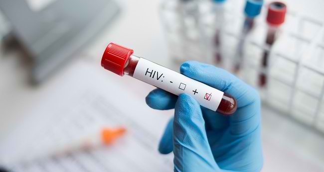 HIV