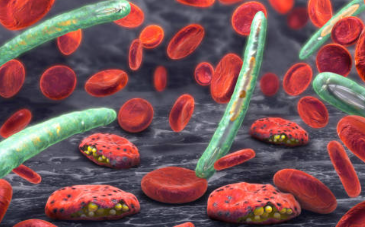 Malaria