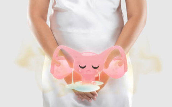 Cairan vagina