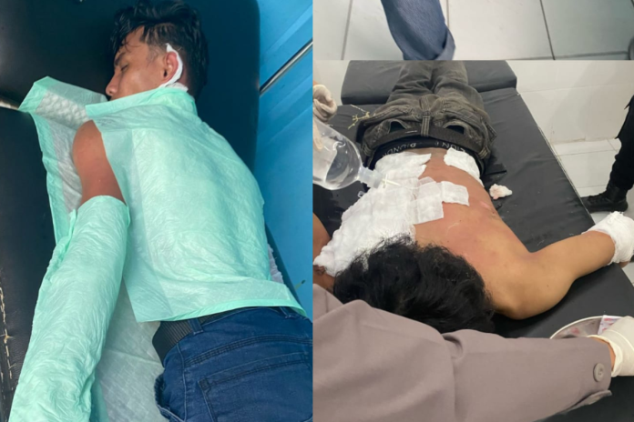 Kader HMI Mengalami Luka Bakar saat Demo di Polda Kaltara
