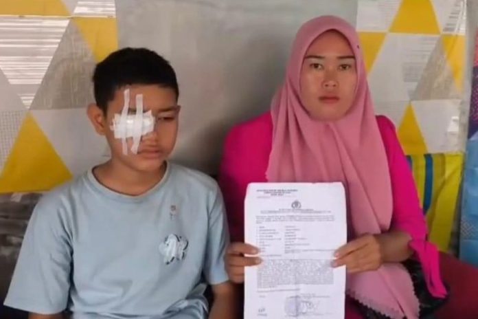 Pelajar SMP Dipanah Pakai Tusuk Bakso