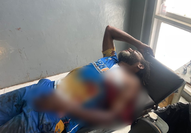 Korban Luka Akibat Ditembak KKB Papua _ HOLOPIS