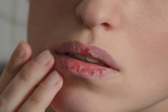 Bibir Holopis.com