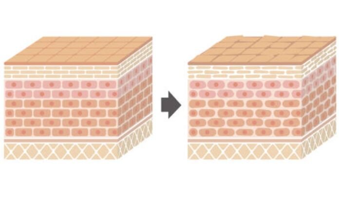 Skin Barrier Holopis