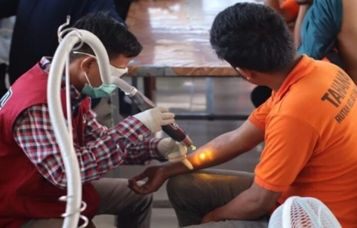 Proses Penghapusan Tatto Holopis
